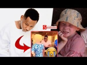 Jahman adopte un albinos : «Li takh ma adopté ko Sama yaram dafa daw.. »