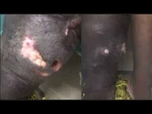 Cri de cœur d’une mère de famille gravement malade