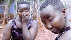 Oh My Good : « Mon mari jaloux m’a enlevé l’œil et coupé les doigts »
