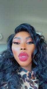 Grosses lèvres : Nabou Dash trahie par sa chirurgie