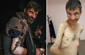 Photos choquantes d’un soldat ukrainien avant et après sa captivité en Russie