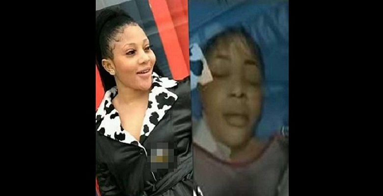 ( Vidéo ) : Elle décède lors d’une chirurgie de liposuccion en Inde