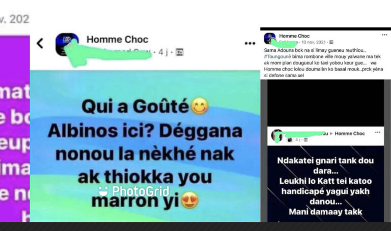 Homme choc : Albinos, naines…, les publications qui choquent le monde féminin