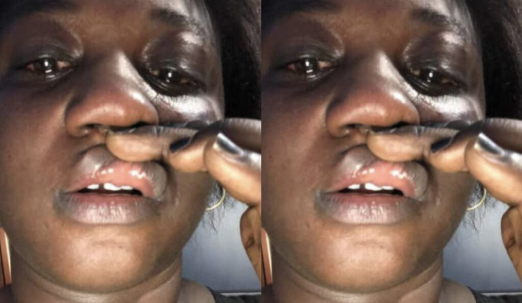 S@uvagement b@ttue par son ex mari: Les images chøquantes de Mya Maboo dévoilées