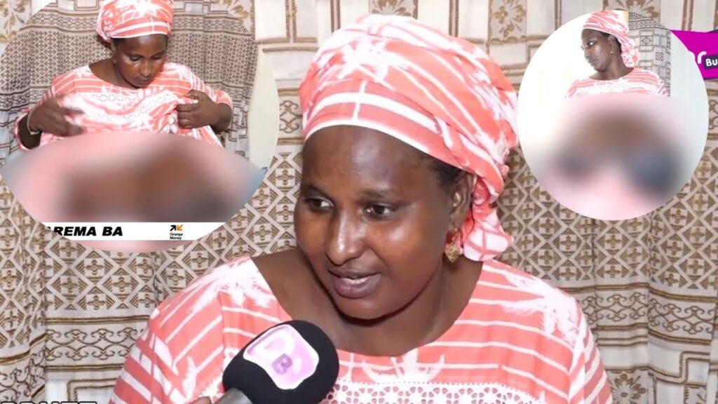 Depuis 2 ans, ses seins ne cessent de grossir : Aby Sow demande de l&rsquo;aide