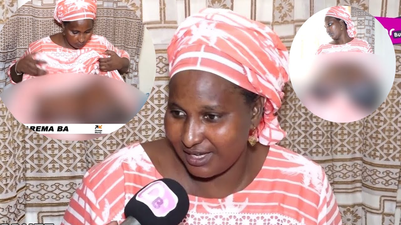 Depuis 2 ans, ses seins ne cessent de grossir : Aby Sow demande de l’aide