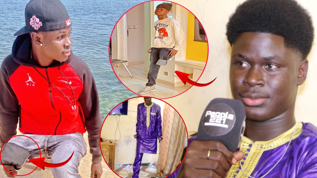 Mass Sarr TikTokeur :  » Le jour où le médecin m&rsquo;a annoncé que ma jambe sera amputée… »