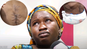 Sos – Mère de Serigne Cissé : « Mon fils souffre, il n&rsquo;a que 3 ans »