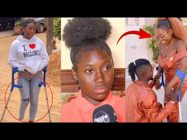 Sa jambe amputée, cette tiktokeuse raconte :  » Sama frère ladone sauvé »