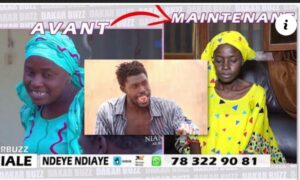 Gravement malade: La comédienne Yado dénonce Niankou :« Plus de 10ans gnoy ande di jouer theatre ma febar tegoufi tankam»
