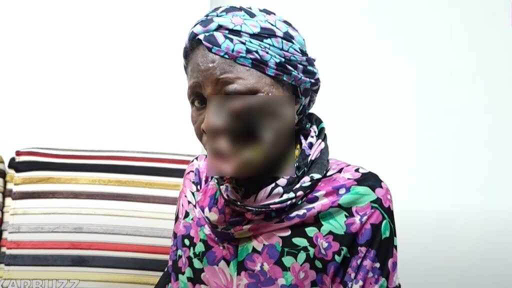 Ames sensibles s’abstenir – Cancer de la joue : Goye Diouf est à assister d&rsquo;urgence