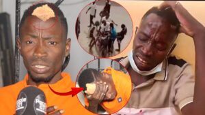 (Vidéo) – Sauvagement agress3, Mbaye Kouthia confie : « Dagn ma door brique… »
