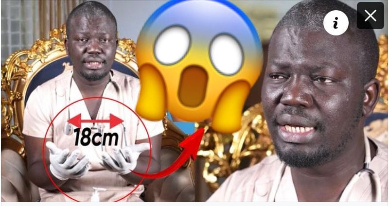 «Awra bou touti»; Cheikh Ahmed Cissé trouve une solution pour les micropenis