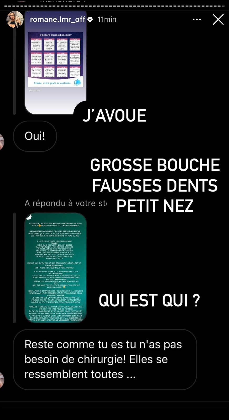 (2) Photos - Romane des Cinquante : Accusations explosives contre les candidates et révélations chocs sur son ex Anthony Mateo