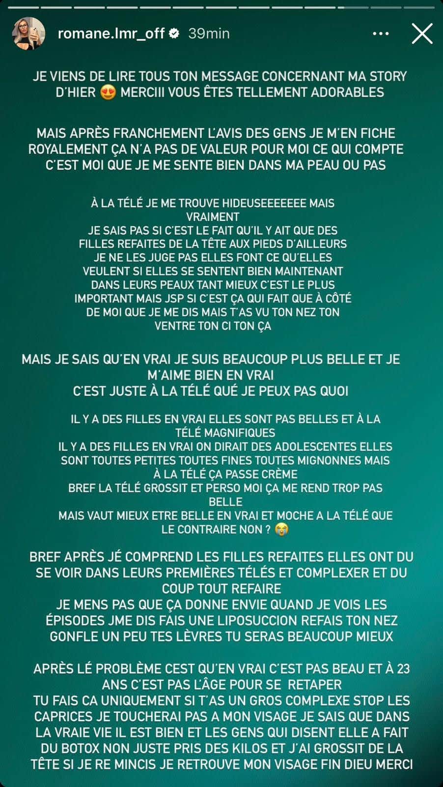 (2) Photos - Romane des Cinquante : Accusations explosives contre les candidates et révélations chocs sur son ex Anthony Mateo