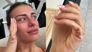 (4) Photos : Giuseppa, en larmes, se confie sur les difficultés et soucis de santé de sa fille
