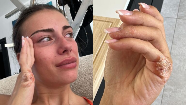 (4) Photos : Giuseppa, en larmes, se confie sur les difficultés et soucis de santé de sa fille