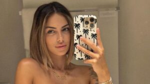 Giuseppa en détresse : L&rsquo;eczéma s&rsquo;intensifie, les fans inquiets