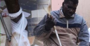 Khadim Ndiaye: Victime d’une grave infect!on au pied…son fils alerte et demande de l’aide