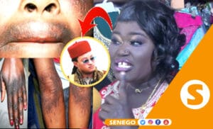xessal kat yi cancer, diabète, Amy Fall révèle d’autres maladies et « cite » Kounkande (Senego Tv)