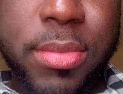 Cancer de la lèvre causé par les « lèvres roses » : Dr Babacar Diop effraye les utilisateurs