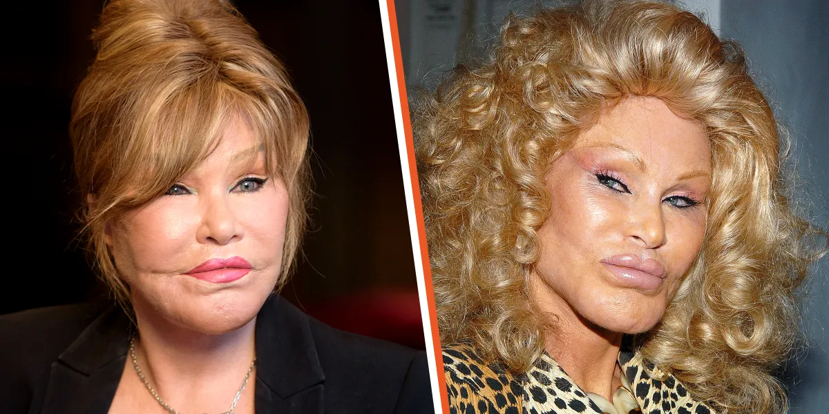 Jocelyn Wildenstein : La mondaine de 82 ans révèle son vrai visage avant sa chirurgie plastique