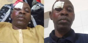 Le Syndicat des travailleurs de la pêche dénonce l&rsquo;agression d&rsquo;Amadou Kandé à Joal