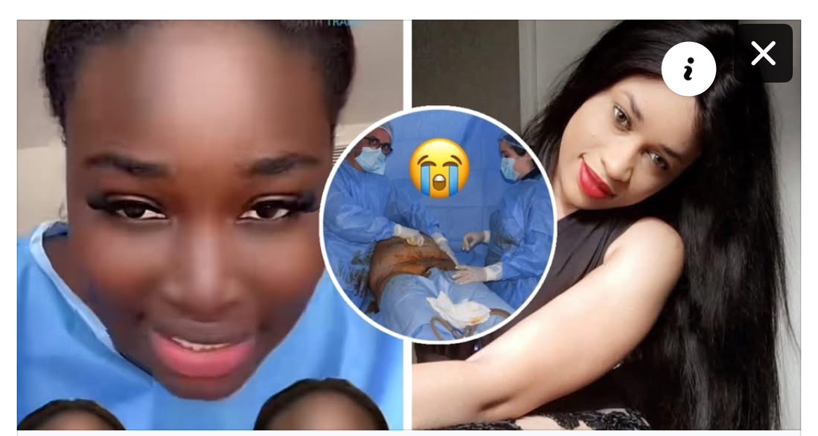 (Vidéo)- L’aveu de Nogaye de la série Bété Bété :« Ma tay deff chirurgie…»