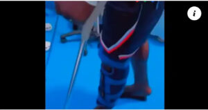 Balla Gaye 2 aperçu à l’hôpital avec des béquilles après sa défaite face à Siteu (vidéo)