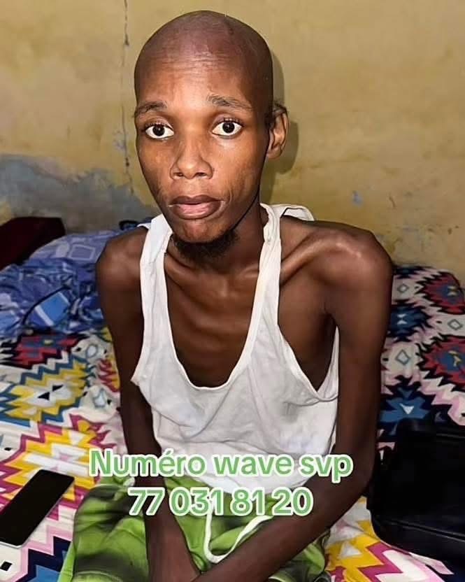 Sa jambe amputée, souffrant de douleurs persistantes, Samba Yoro lance des cris de détresse.