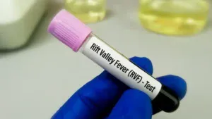 Fièvre de la Vallée du Rift : le Sénégal voit enfin la fin de l’épidémie !