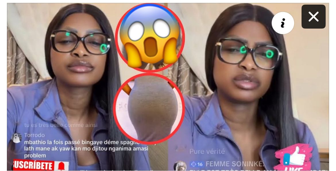 (Vidéo)- Mbathio Ndiaye alerte sur les dangers de la chirurgie: « Certaines ne peuvent plus aller aux toilettes naturellement »