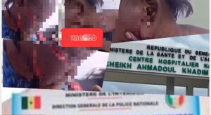 H0rreur à Touba : une infirmière d’état l@céréale visage de sa coepouse