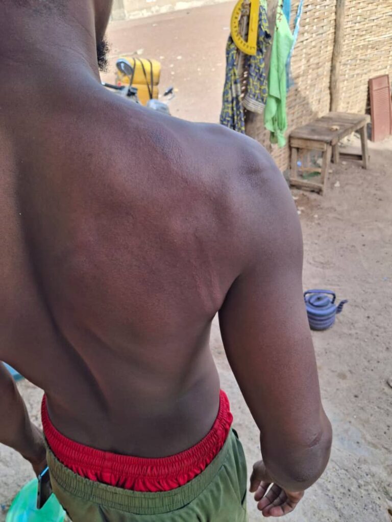 Tambacounda: un directeur d’école accuse des gendarmes de violente agression