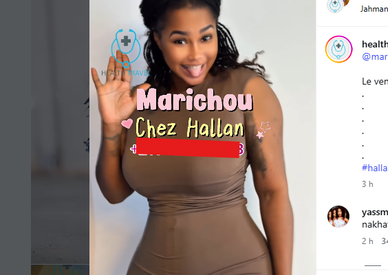Avant/Après sa chirurgie : Marichou choque la toile avec sa transformation