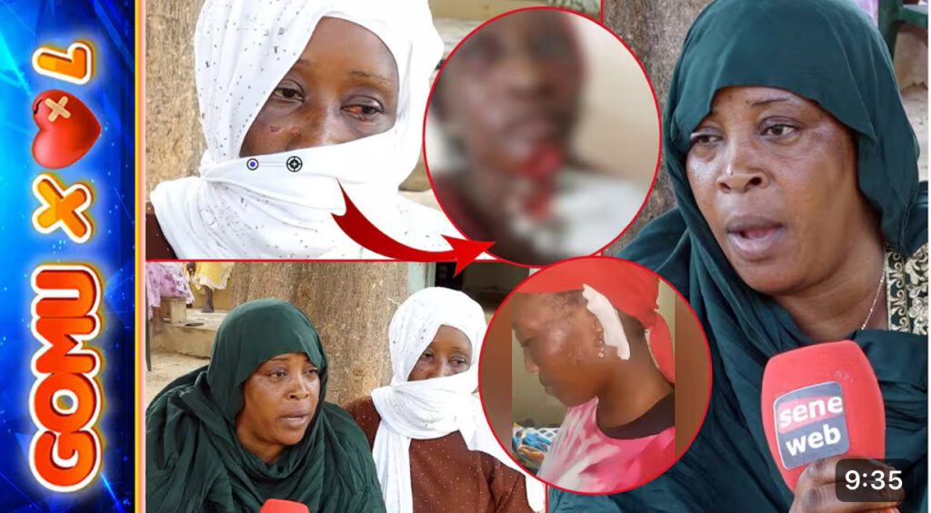 La sœur de la femme mutilée par sa coépouse  brise le silence: « Dafa khampeu sikim bi »