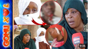 La sœur de la femme mutilée par sa coépouse  brise le silence: « Dafa khampeu sikim bi »