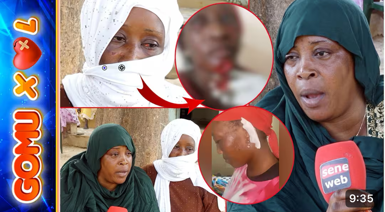 La sœur de la femme mutilée par sa coépouse  brise le silence: « Dafa khampeu sikim bi »