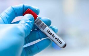 Un premier cas d&rsquo;Ebola confirmé en France chez un médecin humanitaire