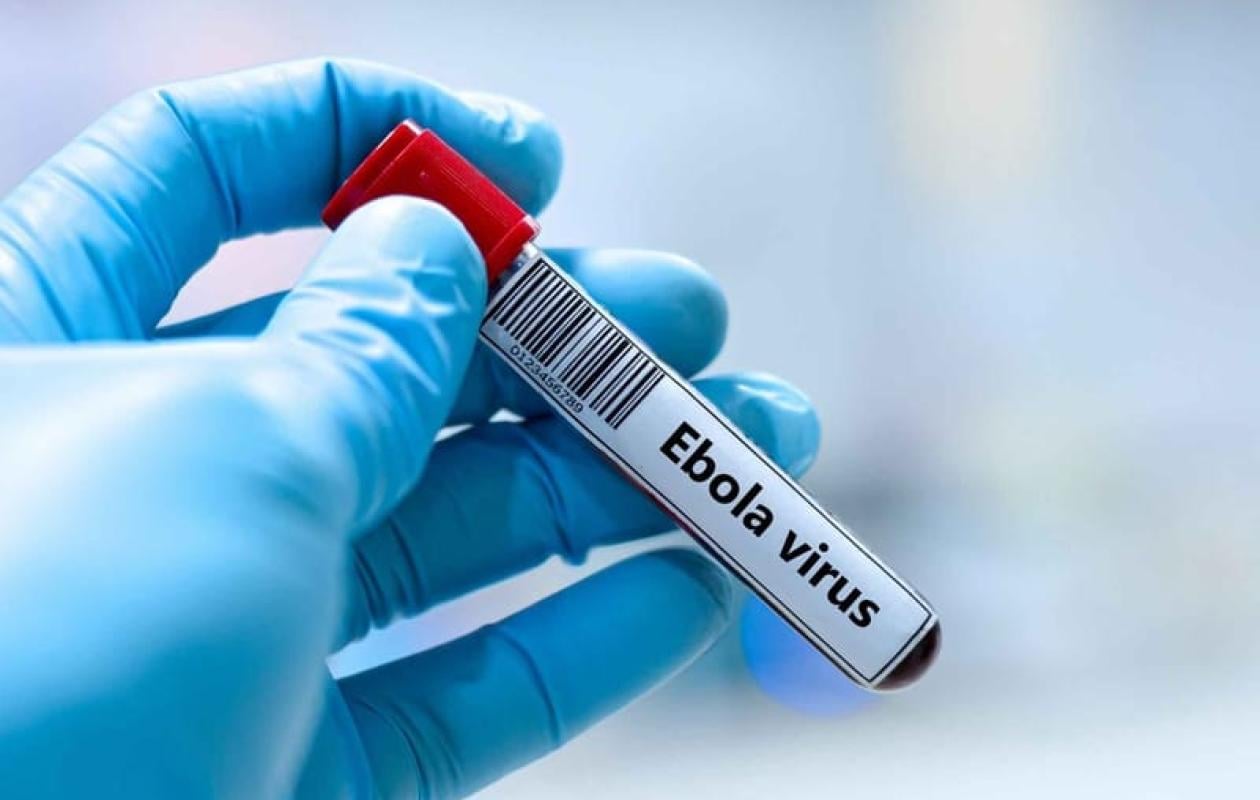 Un premier cas d&rsquo;Ebola confirmé en France chez un médecin humanitaire